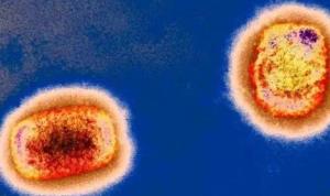 重庆确诊1例猴痘病例 专家：疫情传播风险很低