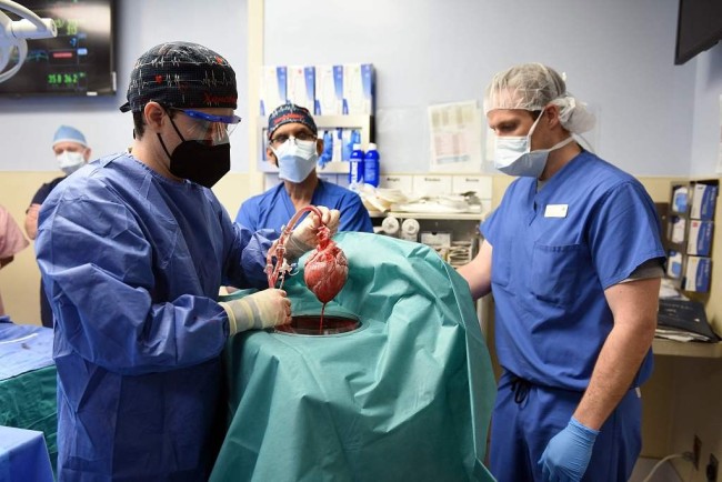全球首个接受猪心脏移植病患死亡距手术约2个月