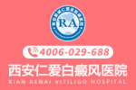 白斑专项：西安专业治疗白癜风医院名单