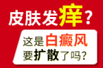 今日新闻：西安看白癜风医院前十排行榜