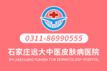 沧州比较专业的白癜风医院是哪家 男性白癜风如何治疗更好呢
