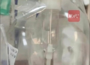 三岁患儿输液管内发现头发 医患双方各执一词待鉴定