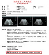 一女子怀孕后B超却探查不到宝宝 医生检查后惊了：非常罕见…