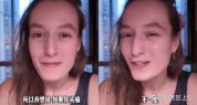 法國女孩頭痛多年在中國找到病因
