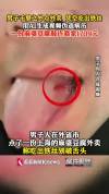 男子AI伪造病历跨省敲诈外卖商家 虚假伤情多次索赔