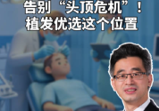 植发优选这2个位置