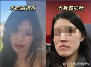 武大口腔手术纠纷 达成和解希望回归正常生活