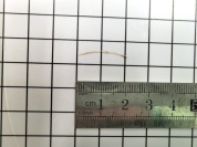 女子腹部“隐痛”一个月，元凶竟是一根鱼刺