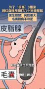 网红梅尼耶妻子颅顶打针增高 风险大不可逆
