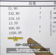 比砒霜还毒!一盘凉拌黄瓜致男子肝衰竭