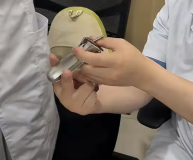 医生：用鸭嘴钳是否疼痛有多重因素 手法与工具尺寸是关键