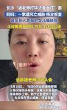 9歲女童被打碎頭骨母親最新發(fā)聲 遭受死亡威脅