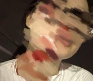 女子在成都綠道騎行被魚(yú)線絆倒 安全隱患引關(guān)注