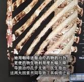 女子吃药用咖啡送服直呼治了个寂寞 药物禁忌需谨记