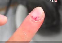 女子给猫洗澡手指被咬穿三个洞 猫咪攻击主人引发热议