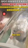 1岁多宝宝吃花生 呛入气管窒息致大脑损伤