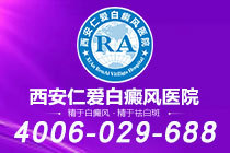 推荐榜单！西安治疗白癜风比较好的医院"排名一览"眼周等敏感部位的白癜风治疗为何需更谨慎