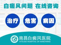 南昌去哪看白癜风医院好-热点宣布：南昌治疗白癜风的医院“排名TOP3”