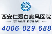 排名揭晓！西安哪个看白癜风的医院正规"重要榜单"白癜风治疗有哪些误区