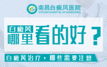 南昌看白癜风不错的医院-南昌看白癜风医院“排名前列”