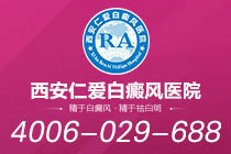 重点关注！西安专业的白癜风医院"热度榜单"白癜风一般长在什么位置