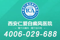 特别关注!西安治白癜风哪的医院好"排行榜"怀疑是白癜风要做哪些检查项目