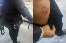 流浪猫8天抓咬3名路人投喂者被起诉 投喂者成被告