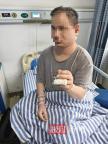 盲人体验小米汽车致手指骨折 安全提醒缺失引争议