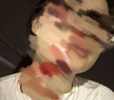 女子在成都綠道騎行被魚線絆倒 安全隱患引關(guān)注