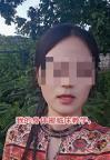 28歲女子做取環(huán)手術(shù)致十級傷殘 小小手術(shù)引發(fā)大傷害