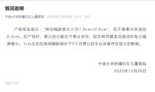 宁波妇儿医院儿胸心外科已处关闭状态 家属质疑手术指征