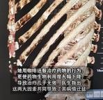 女子吃药用咖啡送服直呼治了个寂寞 药物禁忌需谨记