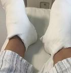 男子钓鱼竿触碰高压线致截肢 警惕头顶隐患