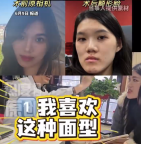 主刀醫(yī)生回應(yīng)女孩正頜變鞋拔子臉：我喜歡這種面型，現(xiàn)在的面型比之前更洋氣