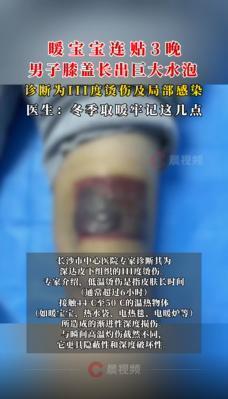 连贴三晚，膝盖深Ⅲ度烫伤！很多人冬天都在用