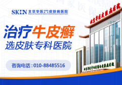 北京什么医院治牛皮癣好-牛皮癣的心理危害