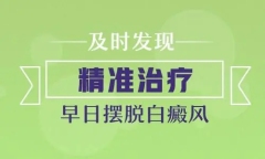 指南播报！南昌好的白癜风医院都在哪里-左手有白斑怎么知道是不是白癜风呢？