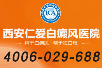 复发研究！铜川看白癜风医院"长期随访"- 白癜风稳定后还会复发吗？