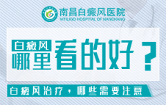 江西治疗白癜风风专科医院-白癜风专栏:南昌白癜风医院今日排名