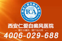 排名出炉！西安有哪些专治白癜风的医院"排行前列"白癜风类型怎么分辨