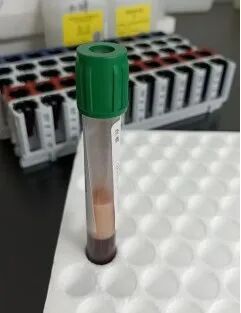 男子抽出草莓奶油血 医生紧急提醒