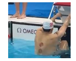 神秘的东方力量！中国游泳队身上全是火罐印 被网友调侃
