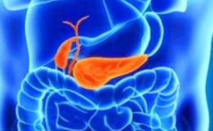 胰腺炎胰腺炎是怎么引起的 胰腺炎的症状有哪些