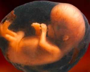 胎儿横位怎么纠正 胎位不正和睡姿有关系吗