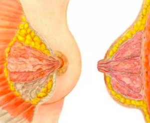 乳腺癌腋窝清扫能治愈吗 具有散结通乳功效的乳腺癌食疗方法