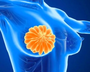 常吃燕麦能降低患乳腺癌危险吗 钙化是癌变信号乳腺需警惕