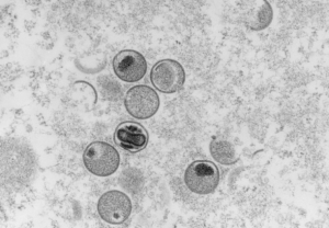 世衛組織公布猴痘病毒分支新命名