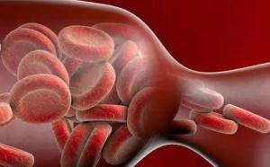 人类血栓中首次发现微塑料、染料颗粒