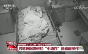 医生发现问题 男童睡眠中经常抖动翻身系癫痫发作