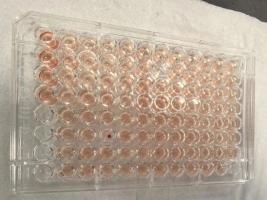 你知道比熊貓血還稀有的血型嗎 揭秘“鉆石血”